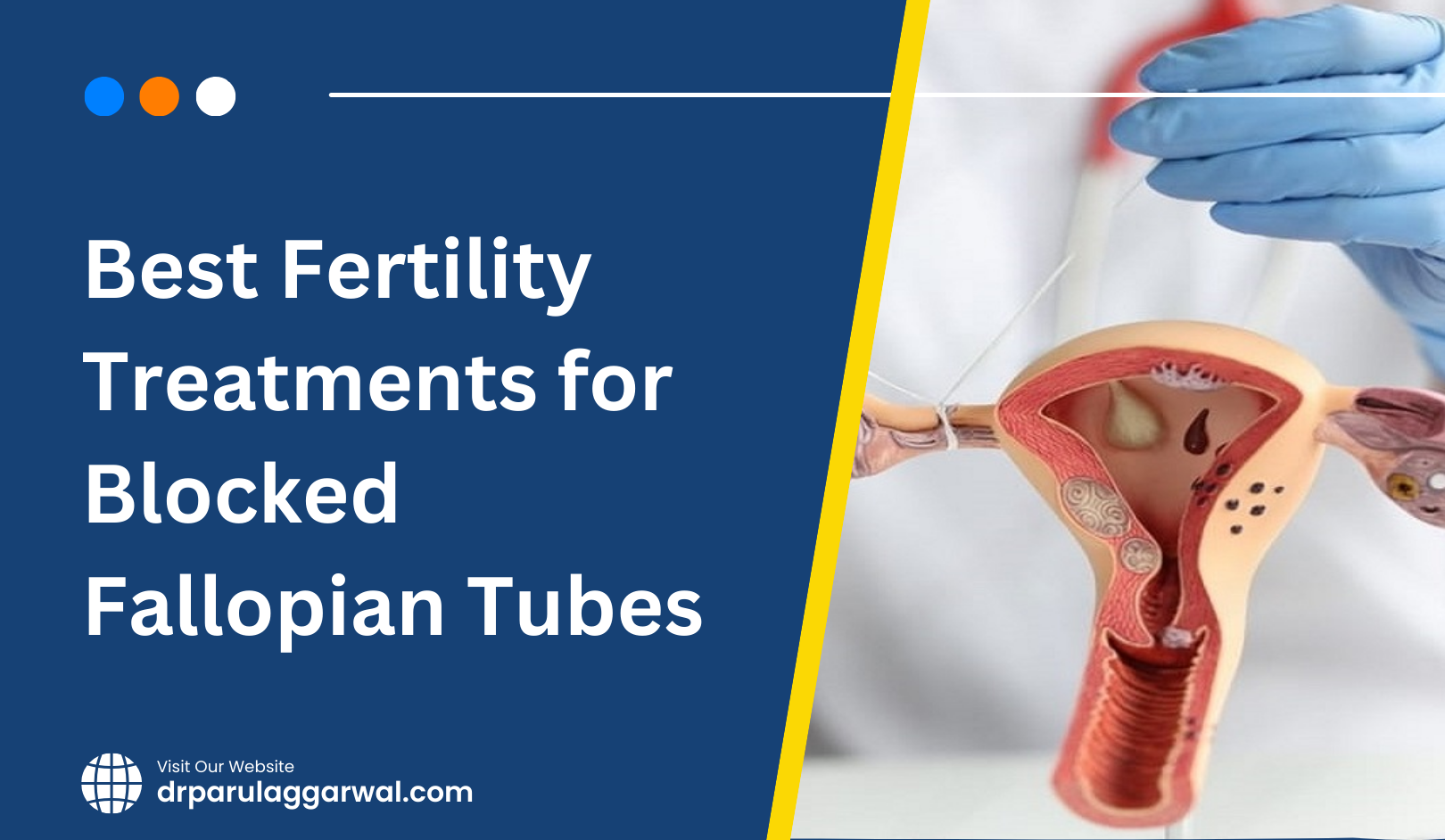 Best Fertility Treatments for Blocked Fallopian Tubes in Noida & Delhi